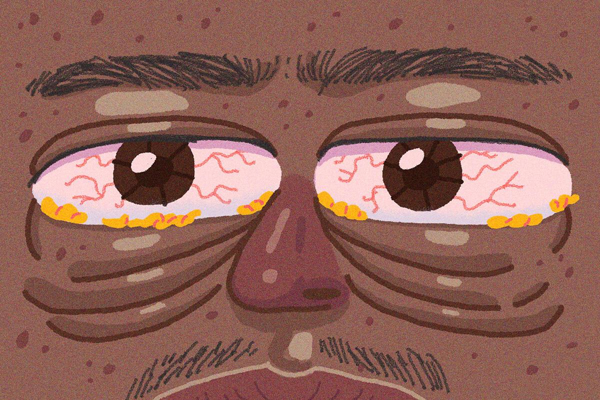 More Than Just Tired: Understanding Chronic Fatigue. Editorial illustration for an article about health, exhaustion, aging, and lack of sleep.